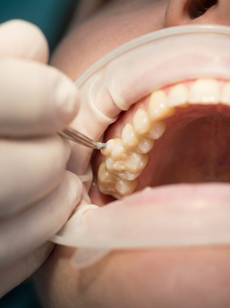 Odontología Conservadora