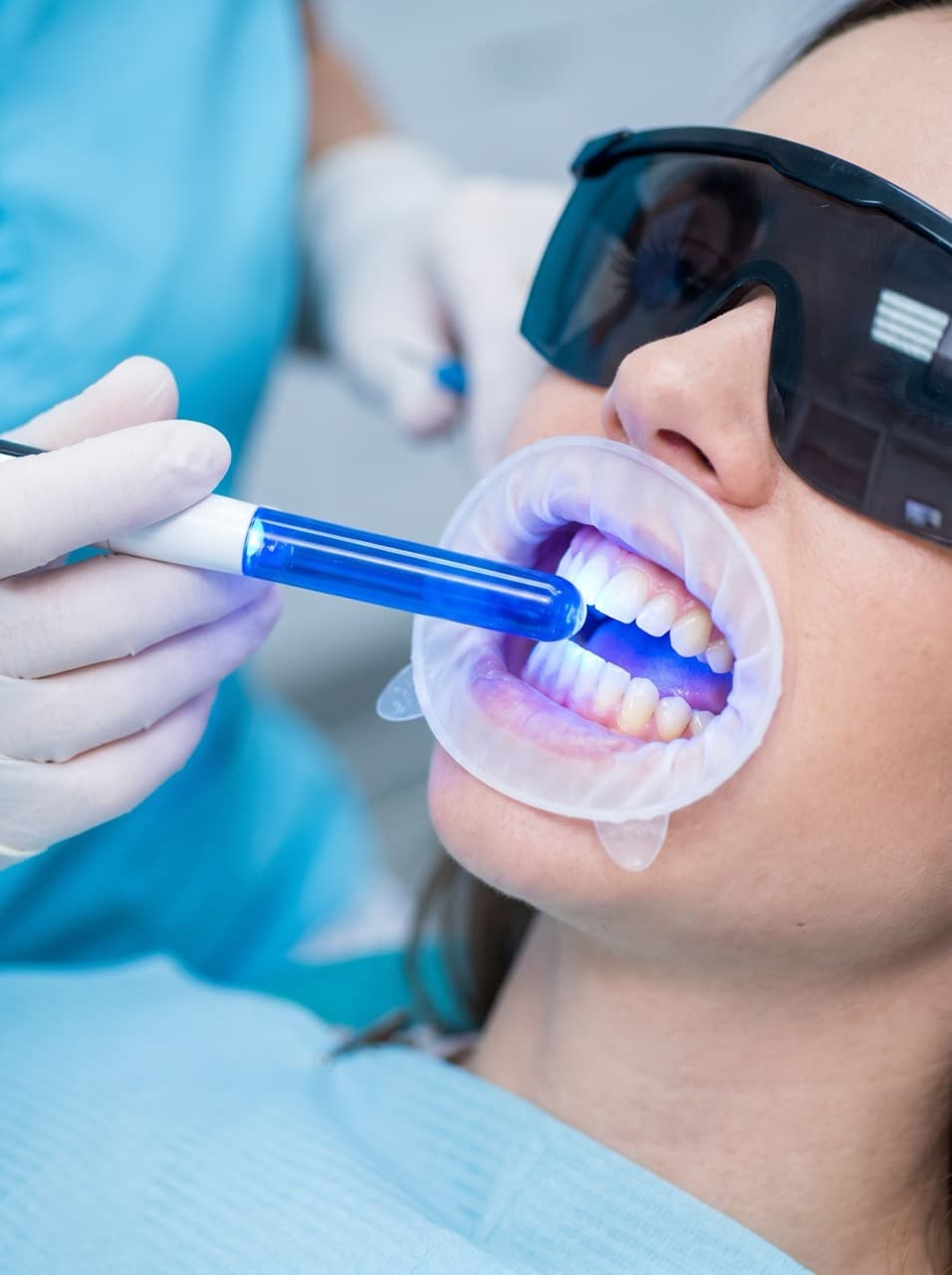 Blanqueamiento Dental