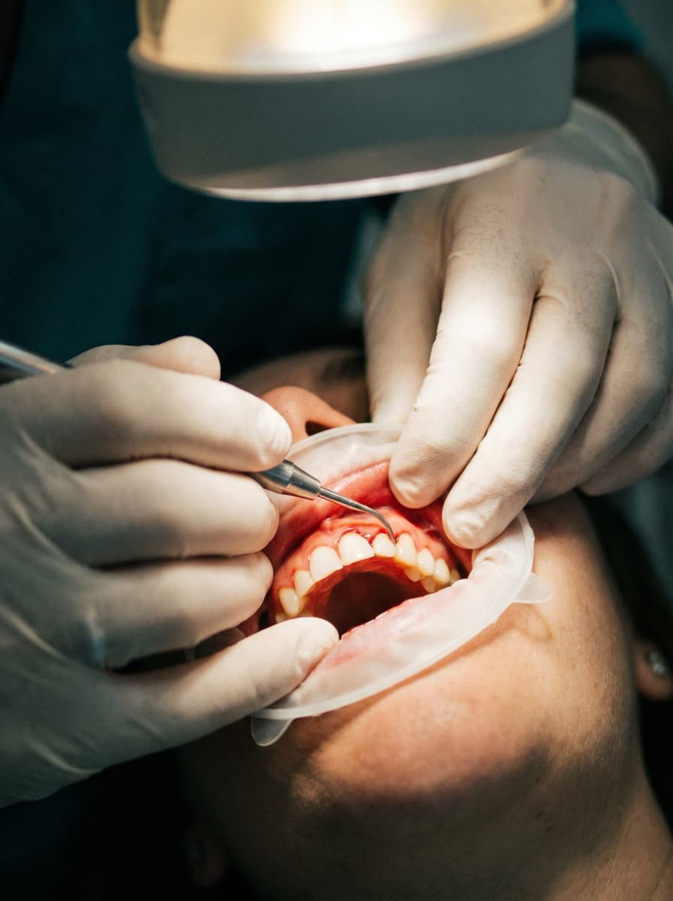 Periodoncia en Granada